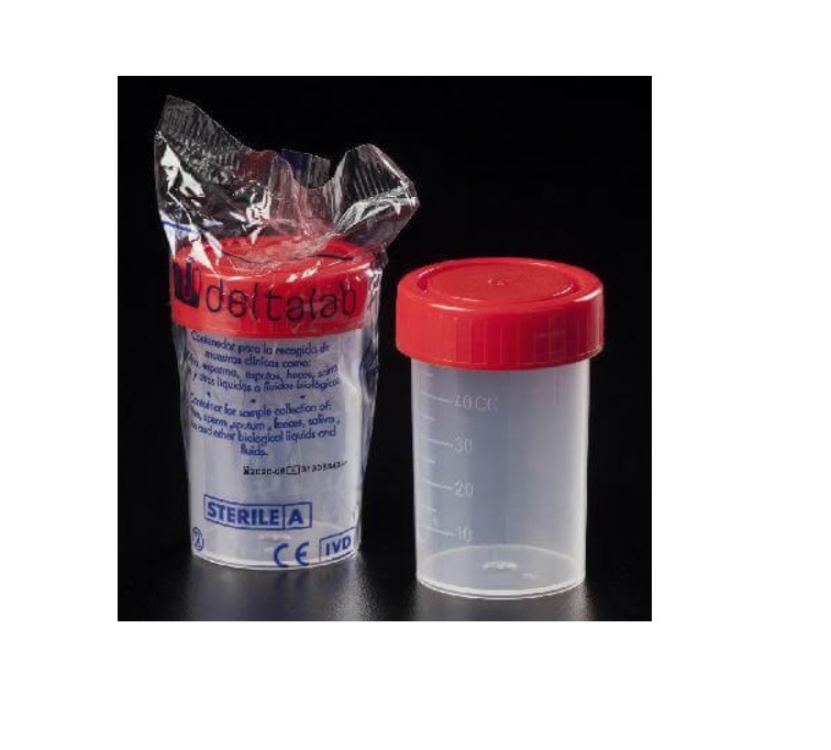Sterilna čašica za urinokulturu, 1 komad